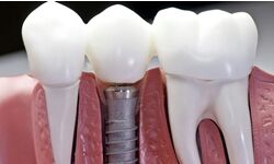 DeathtoStock_SlowDown6