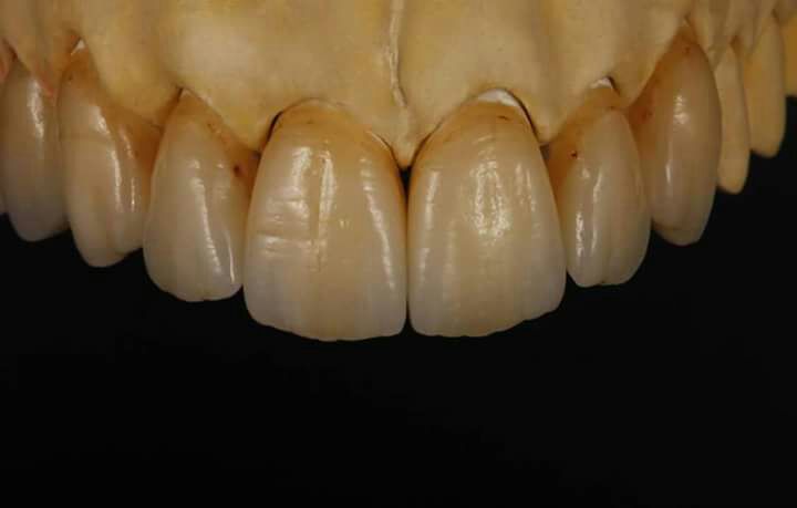 DeathtoStock_SlowDown6