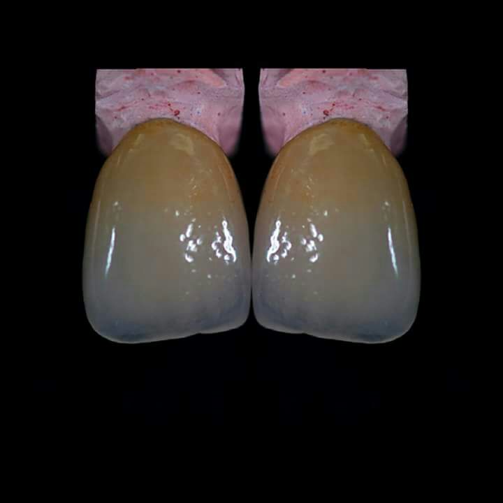 DeathtoStock_SlowDown6