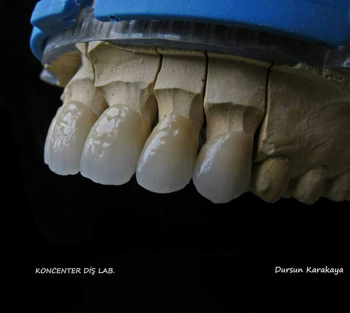 DeathtoStock_SlowDown6