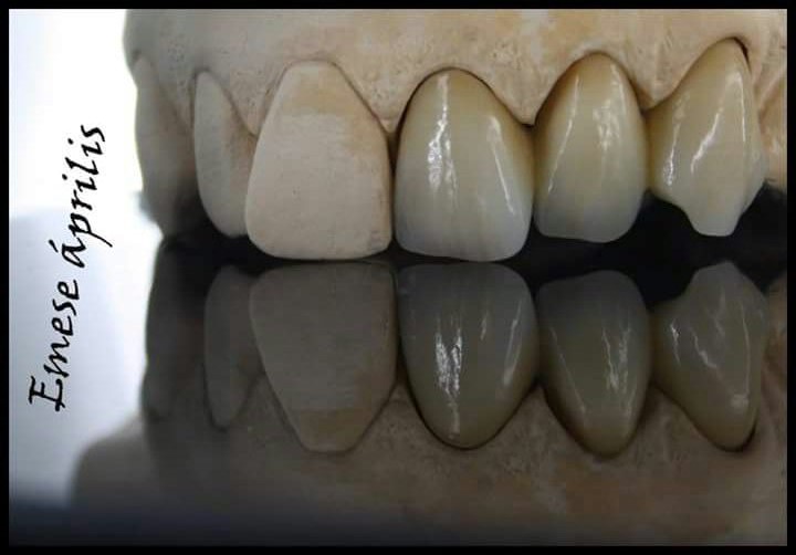 DeathtoStock_SlowDown6