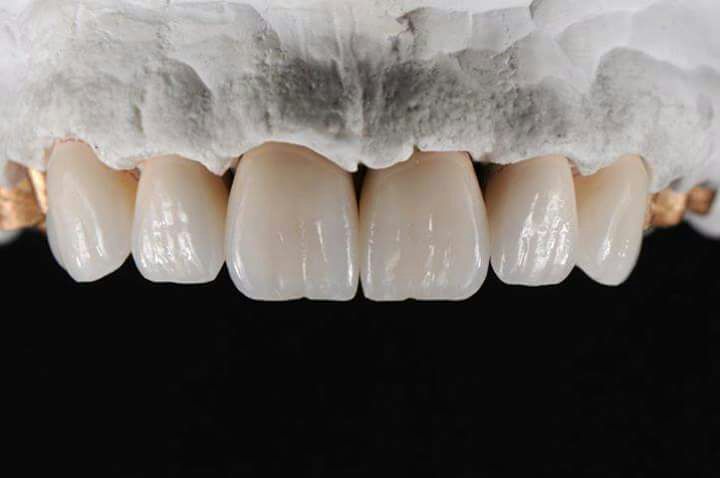 DeathtoStock_SlowDown6