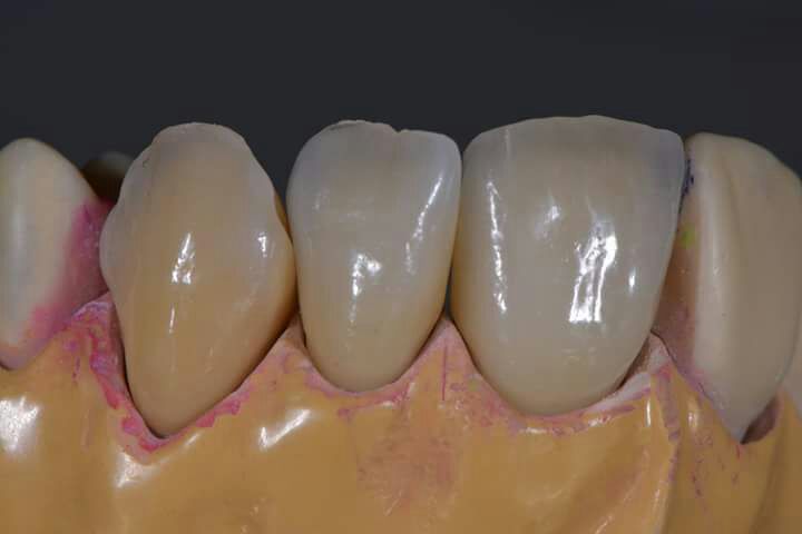 DeathtoStock_SlowDown6