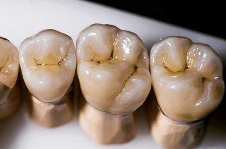 DeathtoStock_SlowDown6