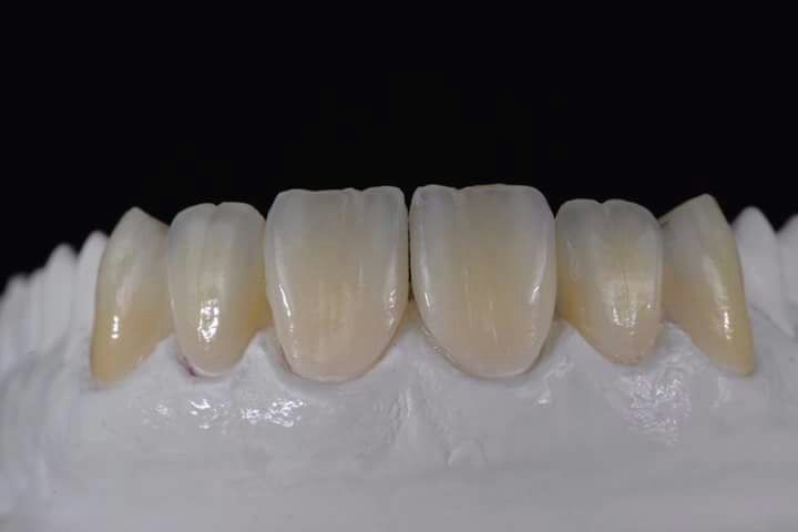 DeathtoStock_SlowDown6