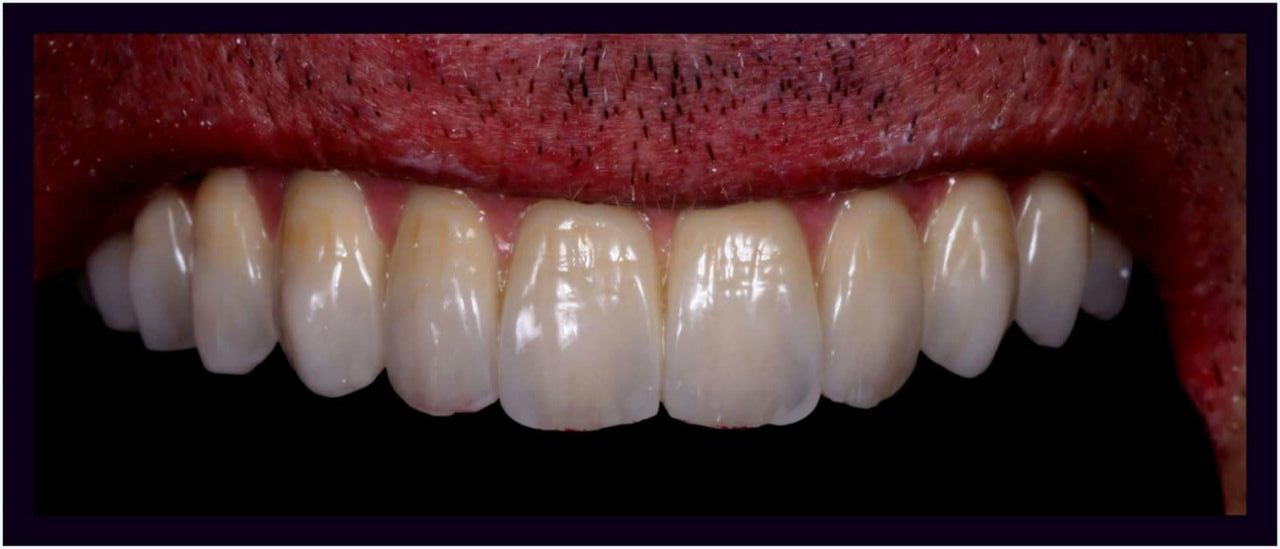 DeathtoStock_SlowDown6