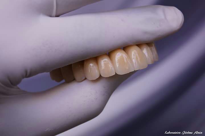 DeathtoStock_SlowDown6