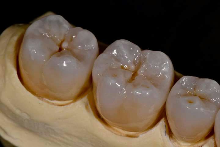 DeathtoStock_SlowDown6