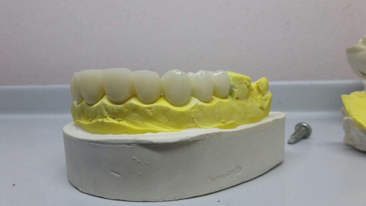 DeathtoStock_SlowDown6