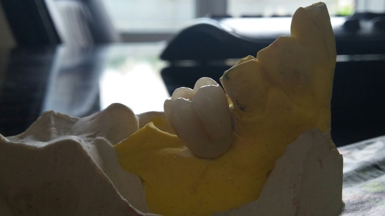 DeathtoStock_SlowDown6